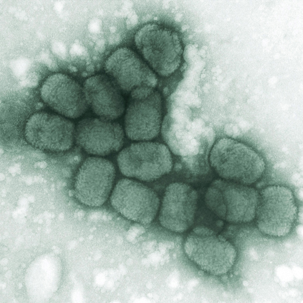 The smallpox virus, photo © Dr. Fred Murphy/CDC